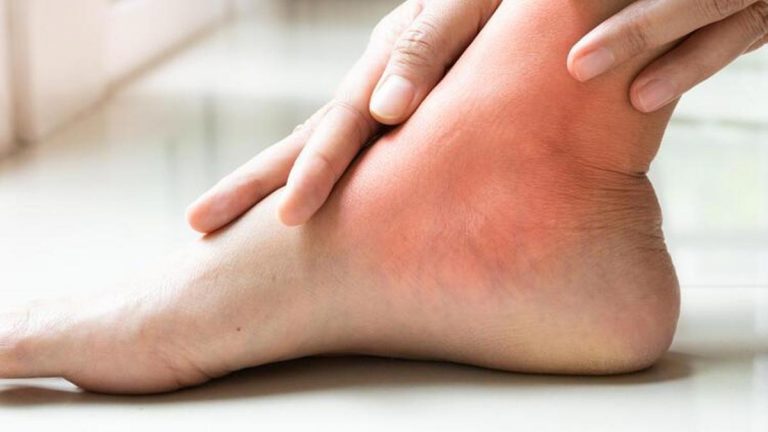 5ff55b635cf3b011c44c8277