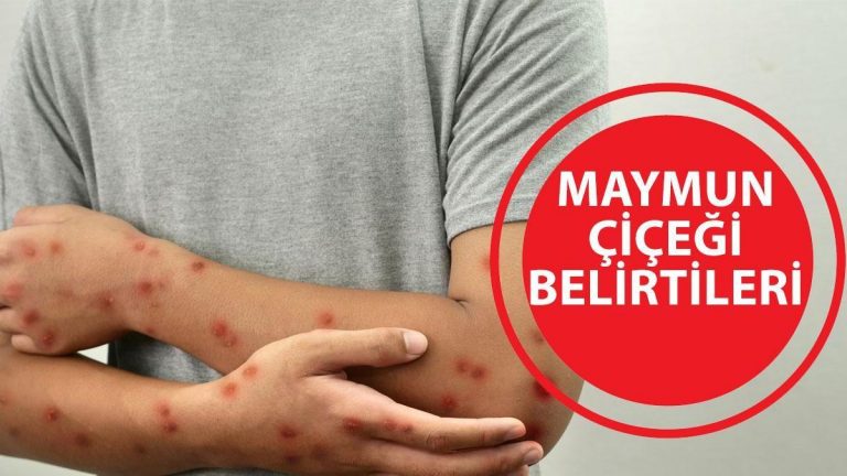 66bd9fc59b4f9a903060bf35