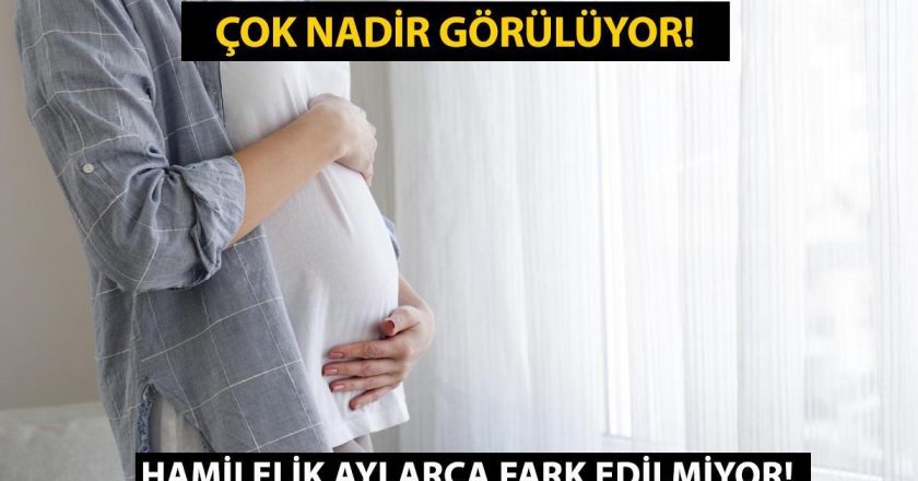 Kriptik gebelik nedir, ne anlama gelir? Kriptik hamileliğin nedenleri ve belirtileri nelerdir?