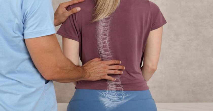 Skolyoz Nedir? Skolyoz Belirtileri, Nedenleri ve Tedavi Yöntemleri Nelerdir?