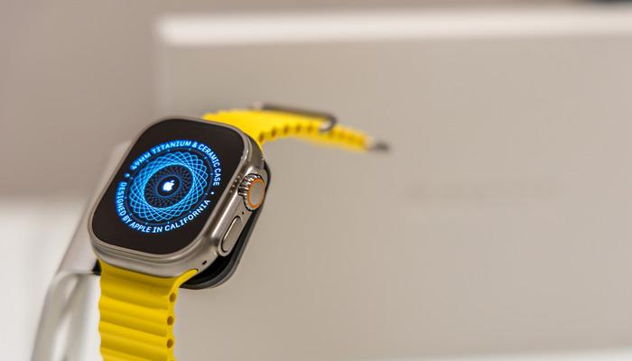 2026 Apple Watch serisi için dikkat çeken iddialar: Son yılların en büyük yükseltmesi olabilir 1 20949968