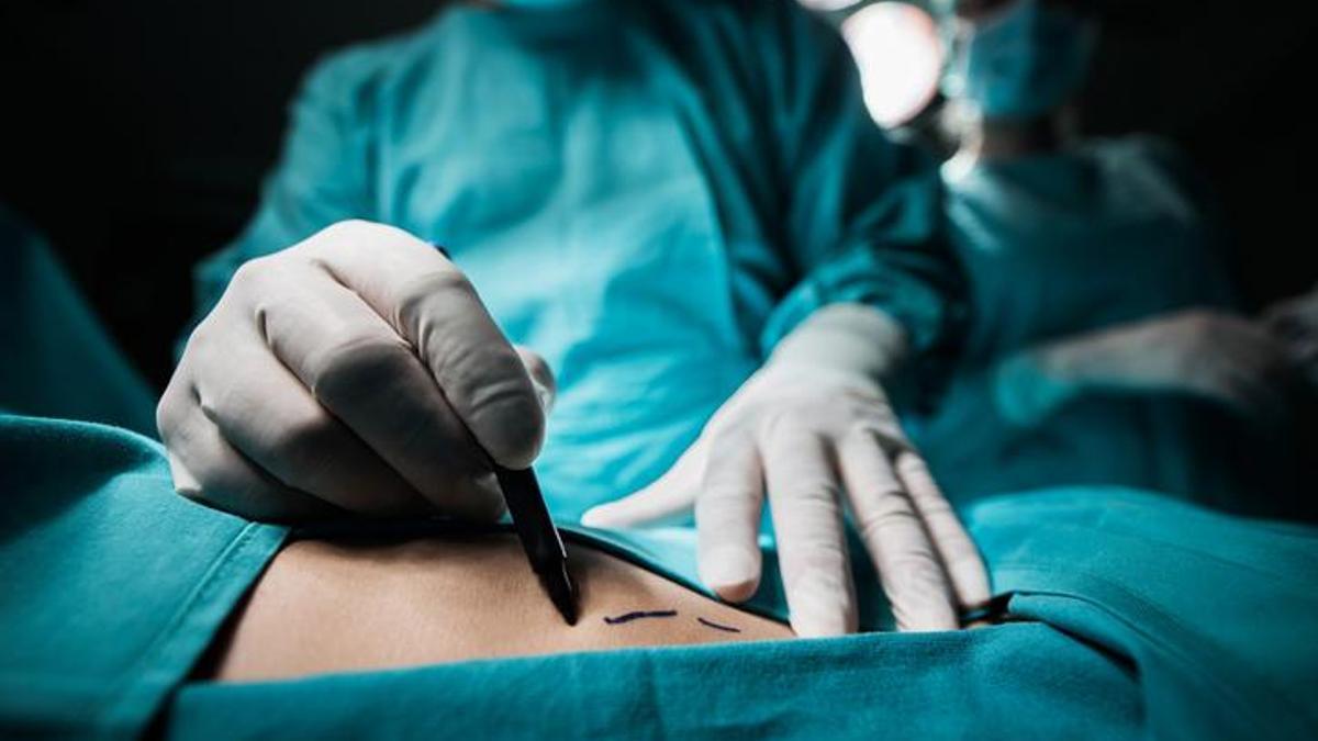 Liposuction Nedir, Nasıl Yapılır? Liposakşın Tedavisi Hangi Durumlarda Uygulanır? 1 68b6c506eb0596da0a97fa29