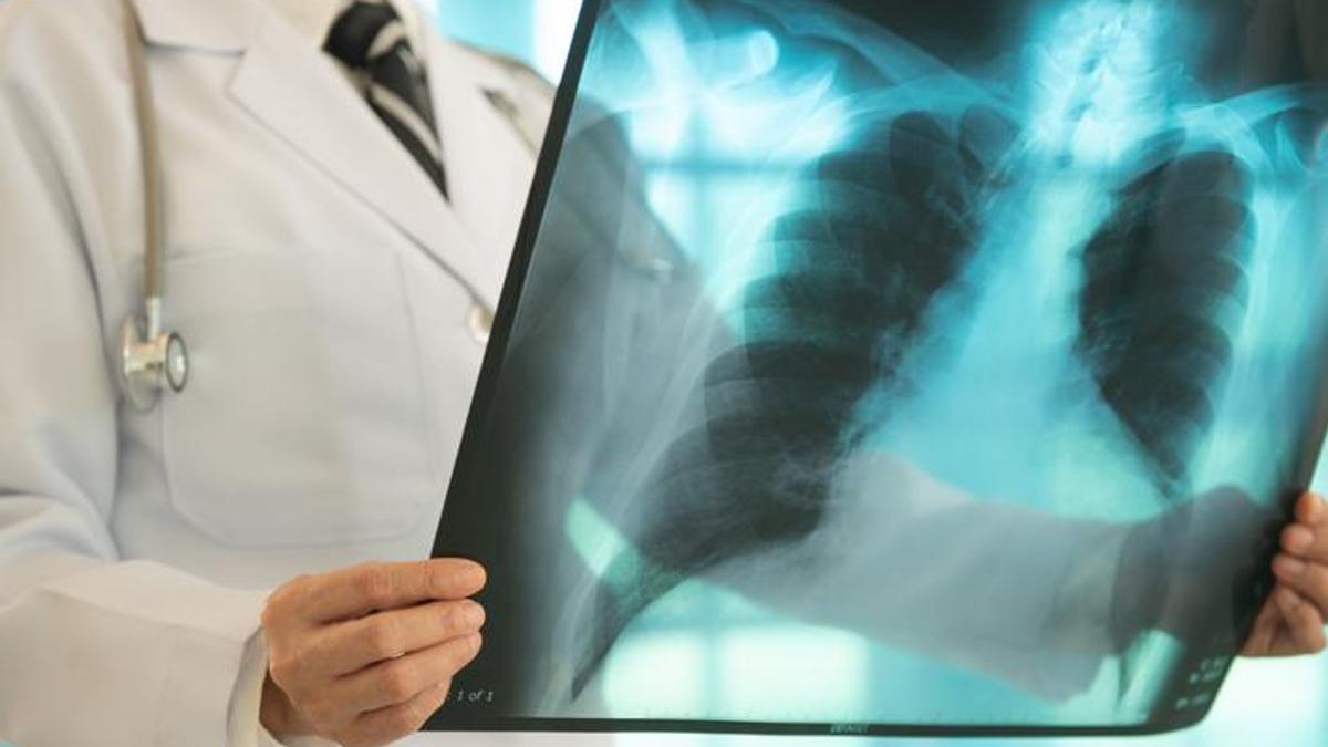 691ae80039465790ca54afd7